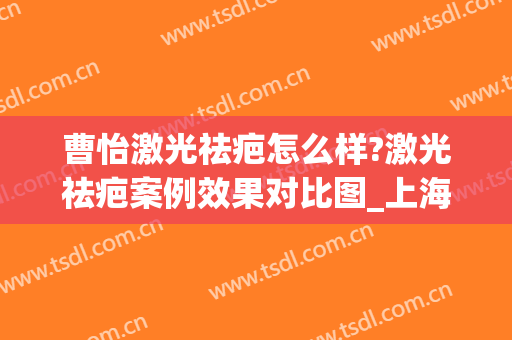 曹怡激光祛疤怎么样?激光祛疤案例效果对比图_上海交通大学医学院附属第九人民医院
