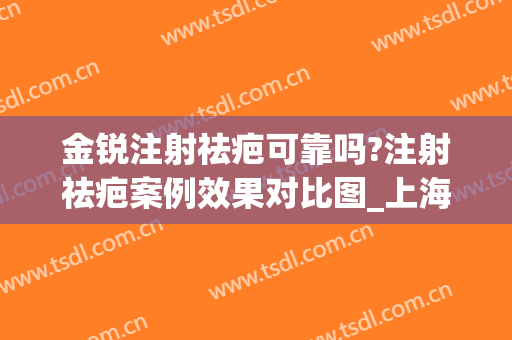 金锐注射祛疤可靠吗?注射祛疤案例效果对比图_上海交通大学医学院附属第九人民医院