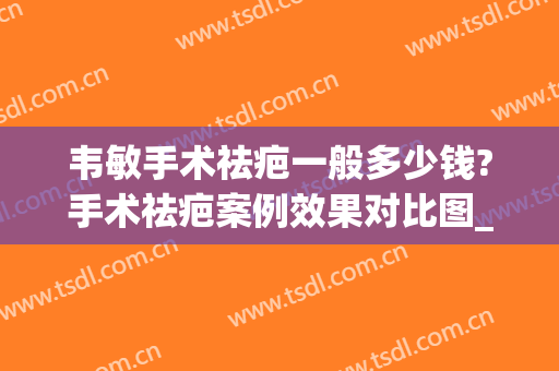 韦敏手术祛疤一般多少钱?手术祛疤案例效果对比图_上海交通大学医学院附属第九人民医院