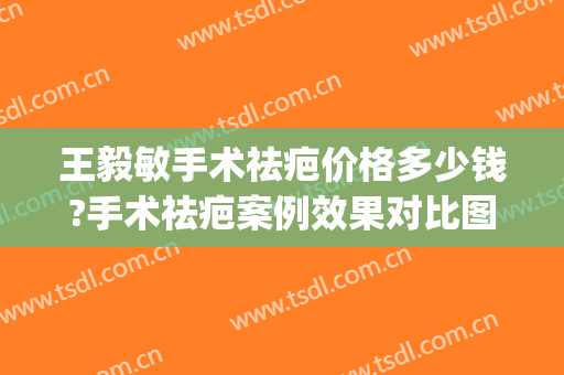 王毅敏手术祛疤价格多少钱?手术祛疤案例效果对比图_上海交通大学医学院附属第九人民医院