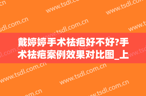 戴婷婷手术祛疤好不好?手术祛疤案例效果对比图_上海交通大学医学院附属第九人民医院