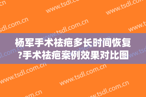 杨军手术祛疤多长时间恢复?手术祛疤案例效果对比图_上海交通大学医学院附属第九人民医院