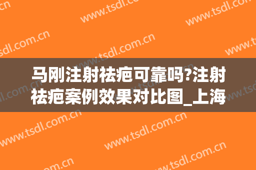 马刚注射祛疤可靠吗?注射祛疤案例效果对比图_上海交通大学医学院附属第九人民医院