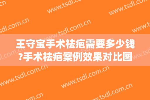 王守宝手术祛疤需要多少钱?手术祛疤案例效果对比图_上海交通大学医学院附属第九人民医院