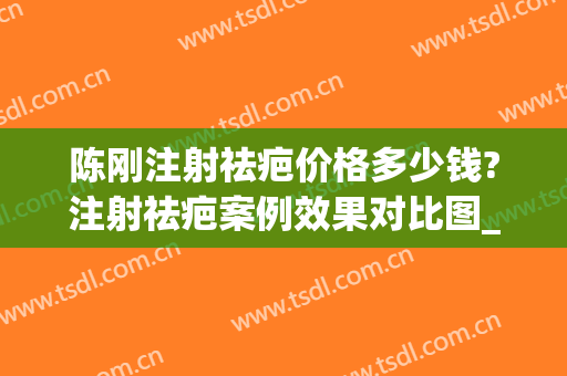 陈刚注射祛疤价格多少钱?注射祛疤案例效果对比图_上海交通大学医学院附属第九人民医院