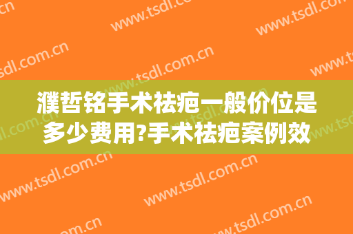 濮哲铭手术祛疤一般价位是多少费用?手术祛疤案例效果对比图_上海交通大学医学院附属第九人民医院
