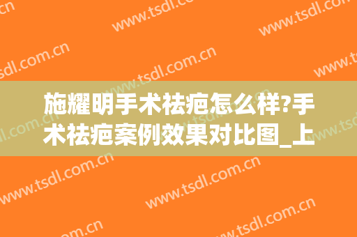 施耀明手术祛疤怎么样?手术祛疤案例效果对比图_上海交通大学医学院附属第九人民医院