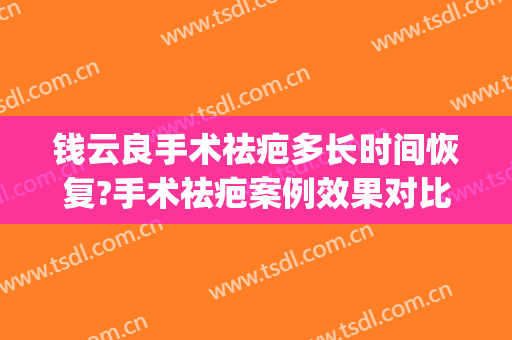 钱云良手术祛疤多长时间恢复?手术祛疤案例效果对比图_上海交通大学医学院附属第九人民医院