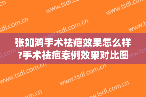 张如鸿手术祛疤效果怎么样?手术祛疤案例效果对比图_上海交通大学医学院附属第九人民医院