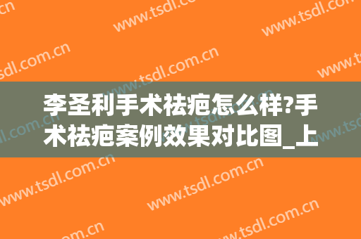 李圣利手术祛疤怎么样?手术祛疤案例效果对比图_上海交通大学医学院附属第九人民医院