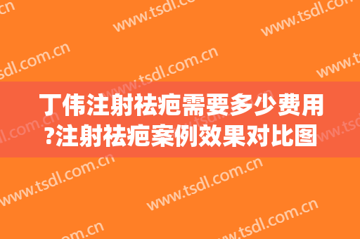 丁伟注射祛疤需要多少费用?注射祛疤案例效果对比图_上海交通大学医学院附属第九人民医院