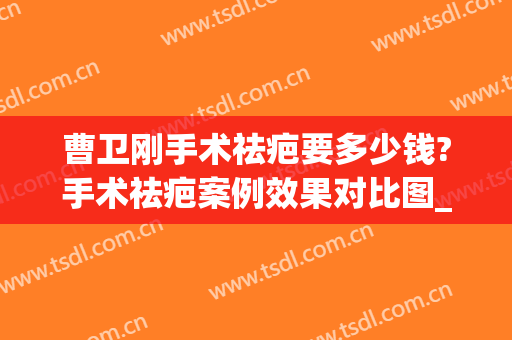 曹卫刚手术祛疤要多少钱?手术祛疤案例效果对比图_上海交通大学医学院附属第九人民医院