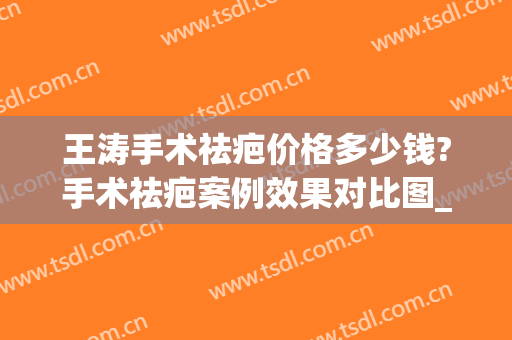 王涛手术祛疤价格多少钱?手术祛疤案例效果对比图_上海交通大学医学院附属第九人民医院