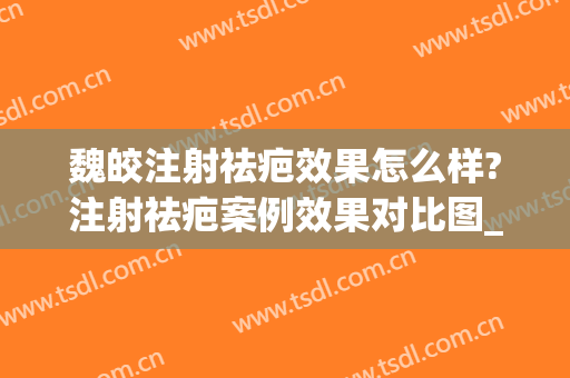 魏皎注射祛疤效果怎么样?注射祛疤案例效果对比图_上海交通大学医学院附属第九人民医院
