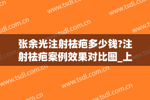 张余光注射祛疤多少钱?注射祛疤案例效果对比图_上海交通大学医学院附属第九人民医院