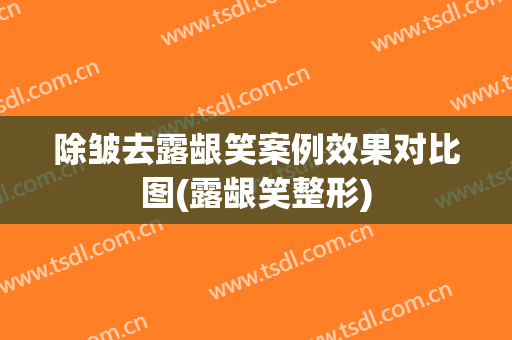 除皱去露龈笑案例效果对比图(露龈笑整形)