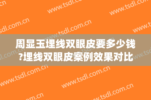 周显玉埋线双眼皮要多少钱?埋线双眼皮案例效果对比图_上海交通大学医学院附属第九人民医院