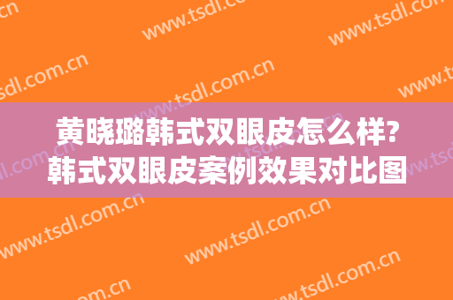 黄晓璐韩式双眼皮怎么样?韩式双眼皮案例效果对比图_上海交通大学医学院附属第九人民医院