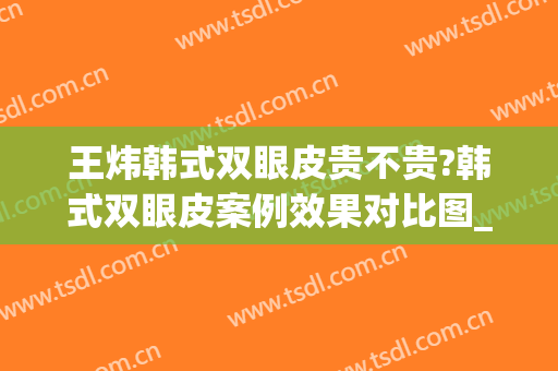 王炜韩式双眼皮贵不贵?韩式双眼皮案例效果对比图_上海交通大学医学院附属第九人民医院