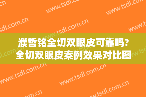 濮哲铭全切双眼皮可靠吗?全切双眼皮案例效果对比图_上海交通大学医学院附属第九人民医院