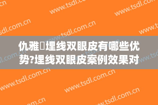 仇雅璟埋线双眼皮有哪些优势?埋线双眼皮案例效果对比图_上海交通大学医学院附属第九人民医院