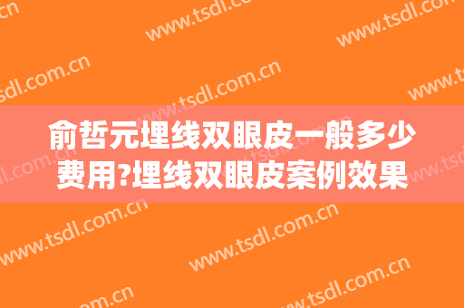 俞哲元埋线双眼皮一般多少费用?埋线双眼皮案例效果对比图_上海交通大学医学院附属第九人民医院