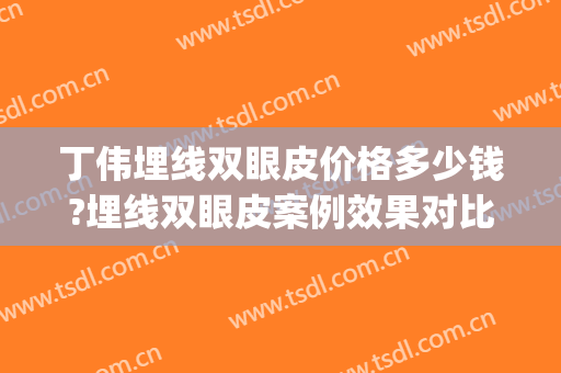 丁伟埋线双眼皮价格多少钱?埋线双眼皮案例效果对比图_上海交通大学医学院附属第九人民医院