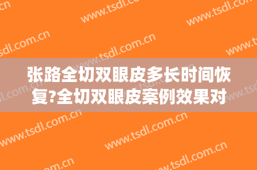 张路全切双眼皮多长时间恢复?全切双眼皮案例效果对比图_上海交通大学医学院附属第九人民医院