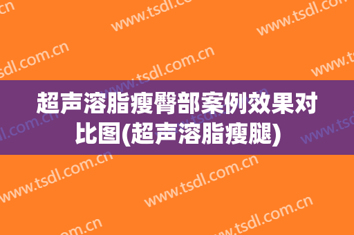 超声溶脂瘦臀部案例效果对比图(超声溶脂瘦腿)