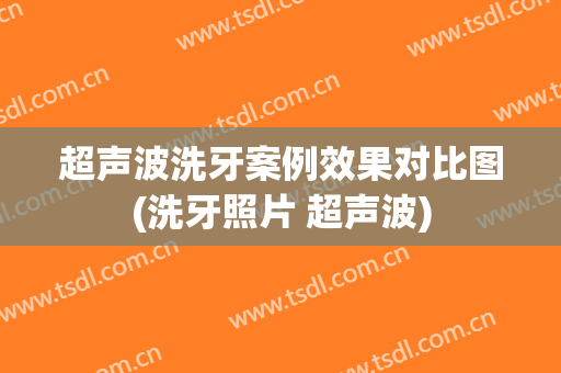 超声波洗牙案例效果对比图(洗牙照片 超声波)