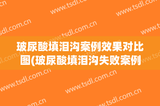 玻尿酸填泪沟案例效果对比图(玻尿酸填泪沟失败案例)