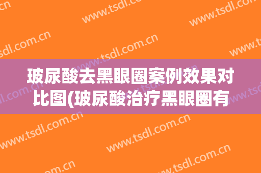玻尿酸去黑眼圈案例效果对比图(玻尿酸治疗黑眼圈有效吗)