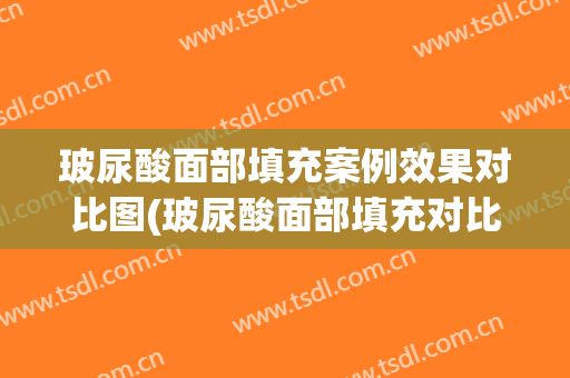 玻尿酸面部填充案例效果对比图(玻尿酸面部填充对比照片)