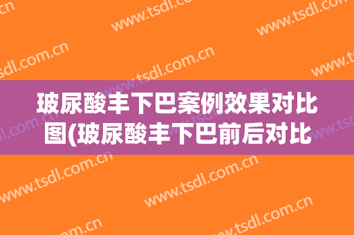 玻尿酸丰下巴案例效果对比图(玻尿酸丰下巴前后对比)