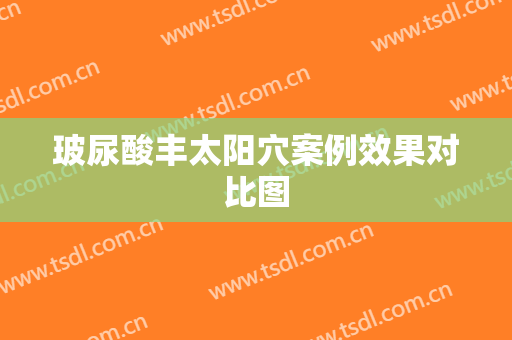 玻尿酸丰太阳穴案例效果对比图