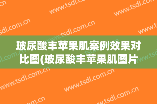 玻尿酸丰苹果肌案例效果对比图(玻尿酸丰苹果肌图片)