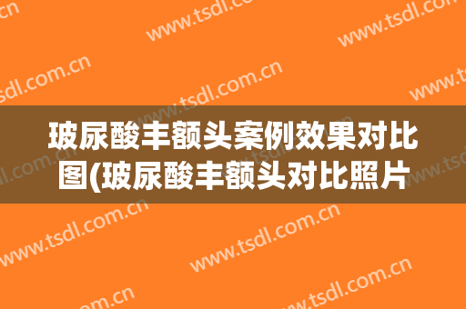 玻尿酸丰额头案例效果对比图(玻尿酸丰额头对比照片)