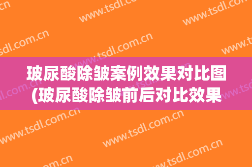 玻尿酸除皱案例效果对比图(玻尿酸除皱前后对比效果图)