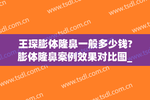 王琛膨体隆鼻一般多少钱?膨体隆鼻案例效果对比图_上海交通大学医学院附属第九人民医院
