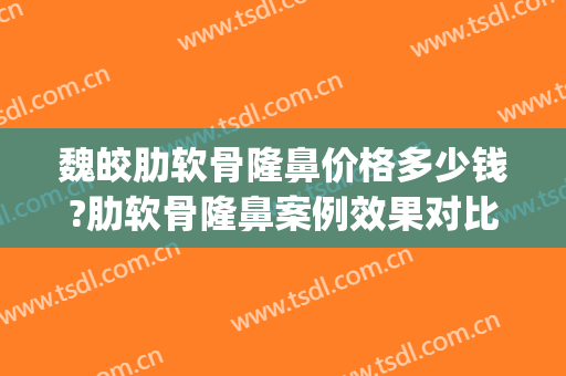 魏皎肋软骨隆鼻价格多少钱?肋软骨隆鼻案例效果对比图_上海交通大学医学院附属第九人民医院