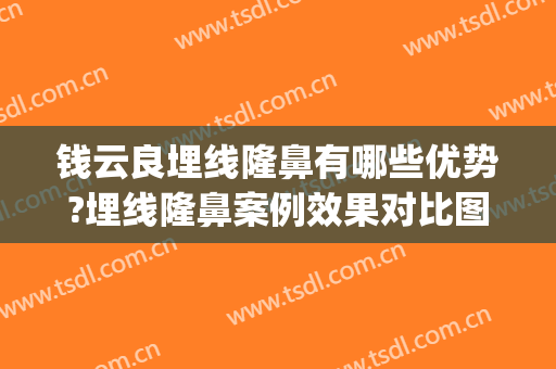 钱云良埋线隆鼻有哪些优势?埋线隆鼻案例效果对比图_上海交通大学医学院附属第九人民医院