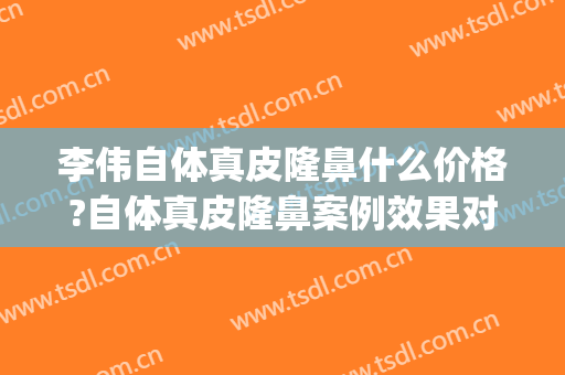 李伟自体真皮隆鼻什么价格?自体真皮隆鼻案例效果对比图_上海交通大学医学院附属第九人民医院