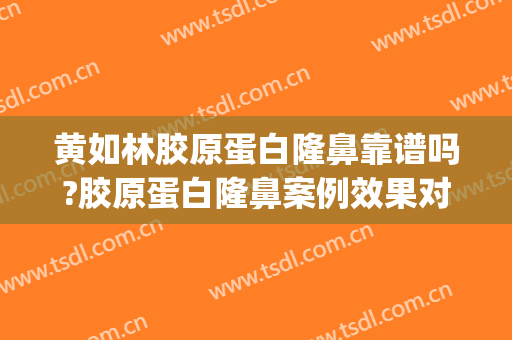 黄如林胶原蛋白隆鼻靠谱吗?胶原蛋白隆鼻案例效果对比图_上海交通大学医学院附属第九人民医院