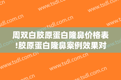 周双白胶原蛋白隆鼻价格表!胶原蛋白隆鼻案例效果对比图_上海交通大学医学院附属第九人民医院