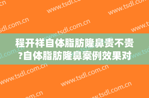 程开祥自体脂肪隆鼻贵不贵?自体脂肪隆鼻案例效果对比图_上海交通大学医学院附属第九人民医院