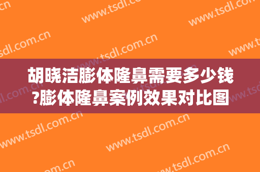 胡晓洁膨体隆鼻需要多少钱?膨体隆鼻案例效果对比图_上海交通大学医学院附属第九人民医院
