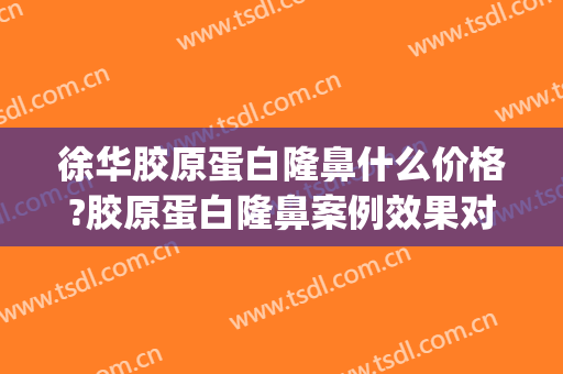 徐华胶原蛋白隆鼻什么价格?胶原蛋白隆鼻案例效果对比图_上海交通大学医学院附属第九人民医院