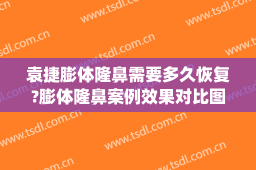 袁捷膨体隆鼻需要多久恢复?膨体隆鼻案例效果对比图_上海交通大学医学院附属第九人民医院