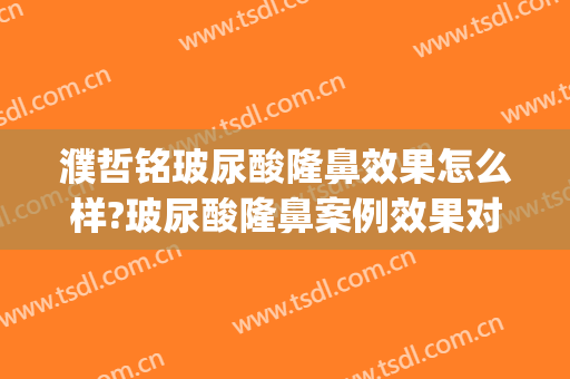 濮哲铭玻尿酸隆鼻效果怎么样?玻尿酸隆鼻案例效果对比图_上海交通大学医学院附属第九人民医院