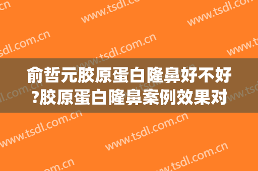 俞哲元胶原蛋白隆鼻好不好?胶原蛋白隆鼻案例效果对比图_上海交通大学医学院附属第九人民医院